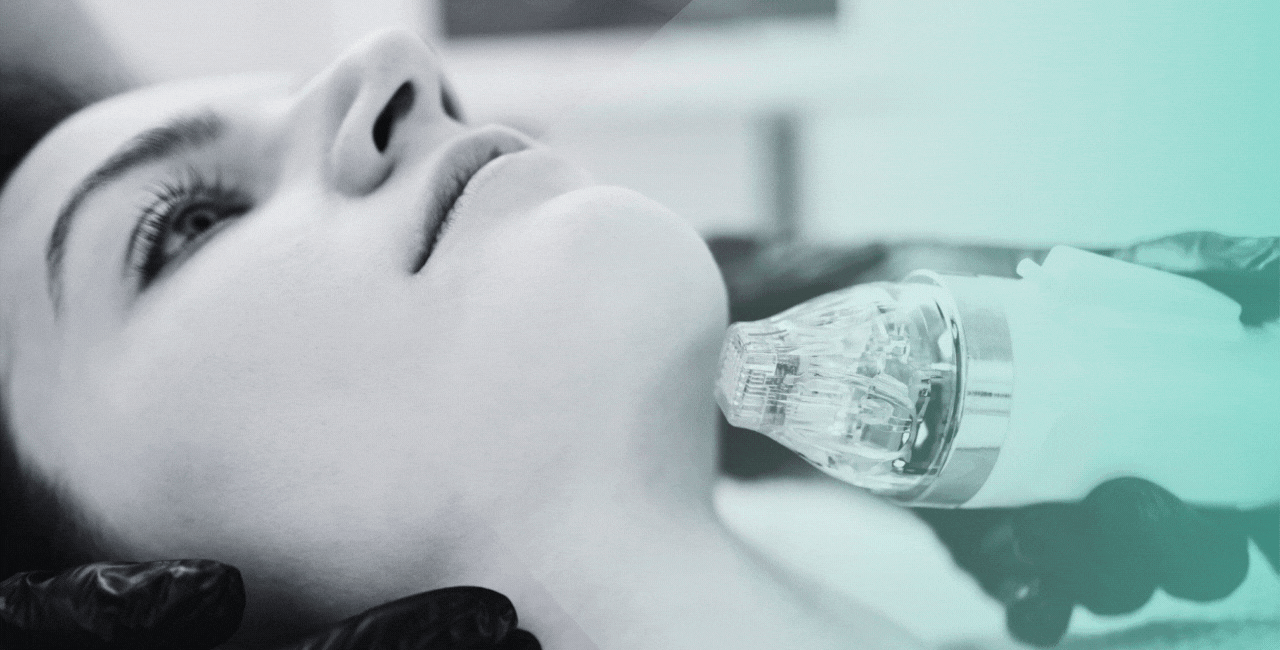 3DEEP® Fractional Skin Resurfacing improves skin smoothness and brightness while reducing hyperpigmentation. Using 112 tiny electrodes, it combines micro-ablation and volumetric heating to promote collagen remodeling and tightening. 
